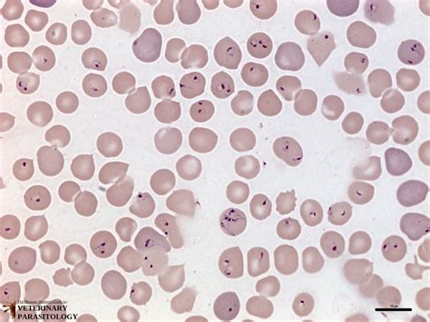  Babesia! Een Microscopisch Monster dat Ons Bloed Besmet