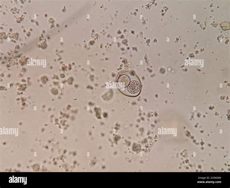  Isospora! Een microscopische wereldreiziger die zich thuisvoelt in de darmen van onze huisdieren