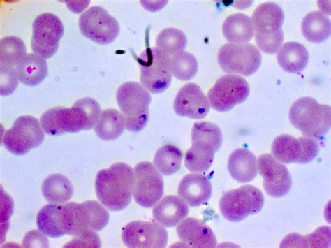  Babesia! Een Microscopisch Wezen Dat Uw Bloed Behandelt Als een Zomers Buffet