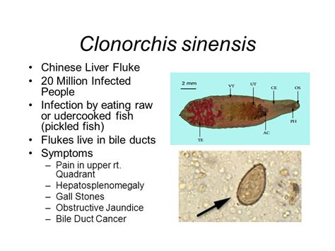  Clonorchis Sinensis: Een Parasiet Met een Voorliefde voor Vis en de Lever van Mensen!