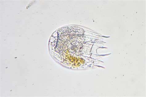  Kentrophilia Keratella! Een Microscopische Bewegende Druppel die de Waterwereld Beheerst